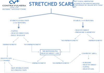 Stretched Scars